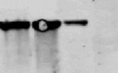 Western blot problem