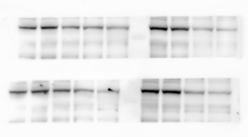 Protein Expression with Western Blotting