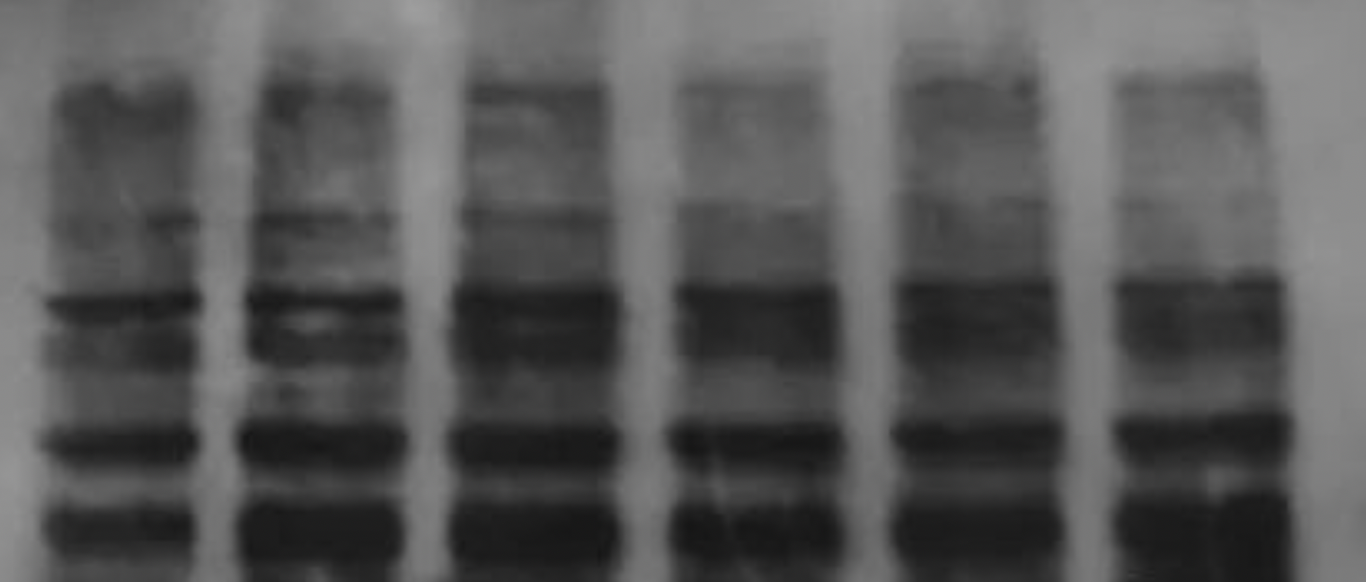 Western blot problem