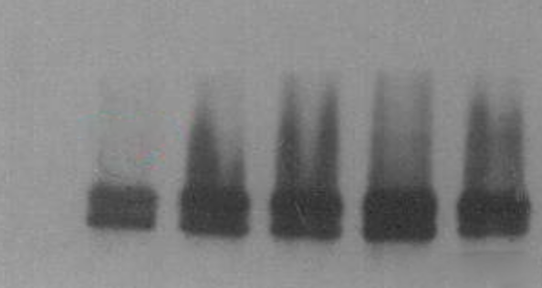 Western blot problem