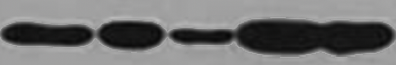 Western blot problem